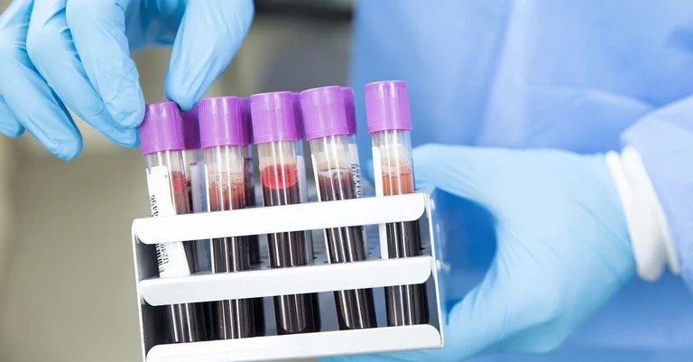 Vorschaubild: Österreich: Hausärzteverband fordert gratis Antikörper-Tests