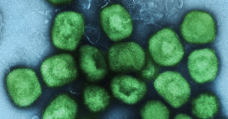 Vorschaubild: Mpox: Affenpocken bekommen neuen Namen