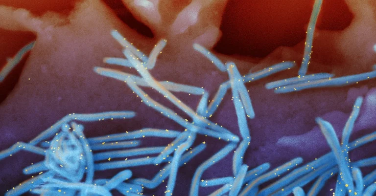 Vorschaubild: RS-Virus bringt Kinderkliniken an Belastungsgrenze