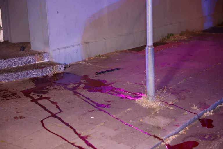 Vorschaubild: Neue Statistik: Zahl der Messerangriffe in Hamburg steigt