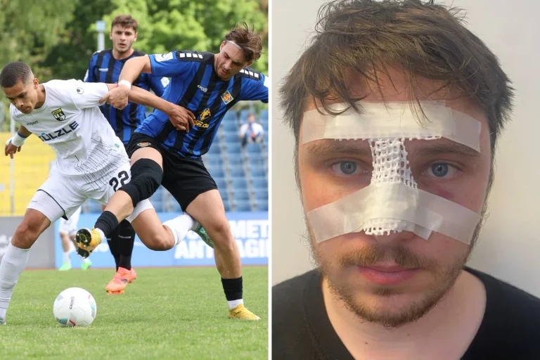 Vorschaubild: Gebrochene Nase: Angriff auf AfD-Wahlkämpfer bei Fußballspiel