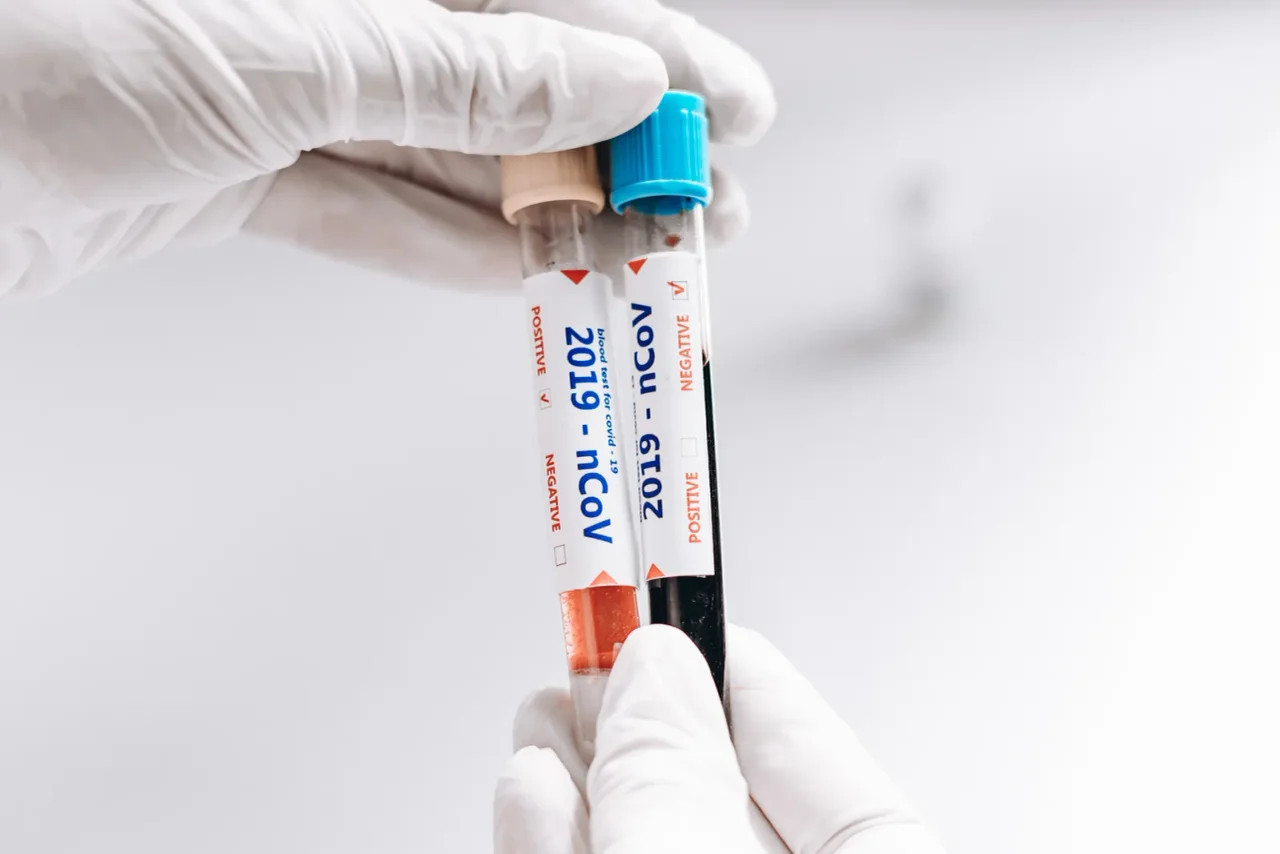 Wissenschaftler wollen den Patient Null gefunden haben