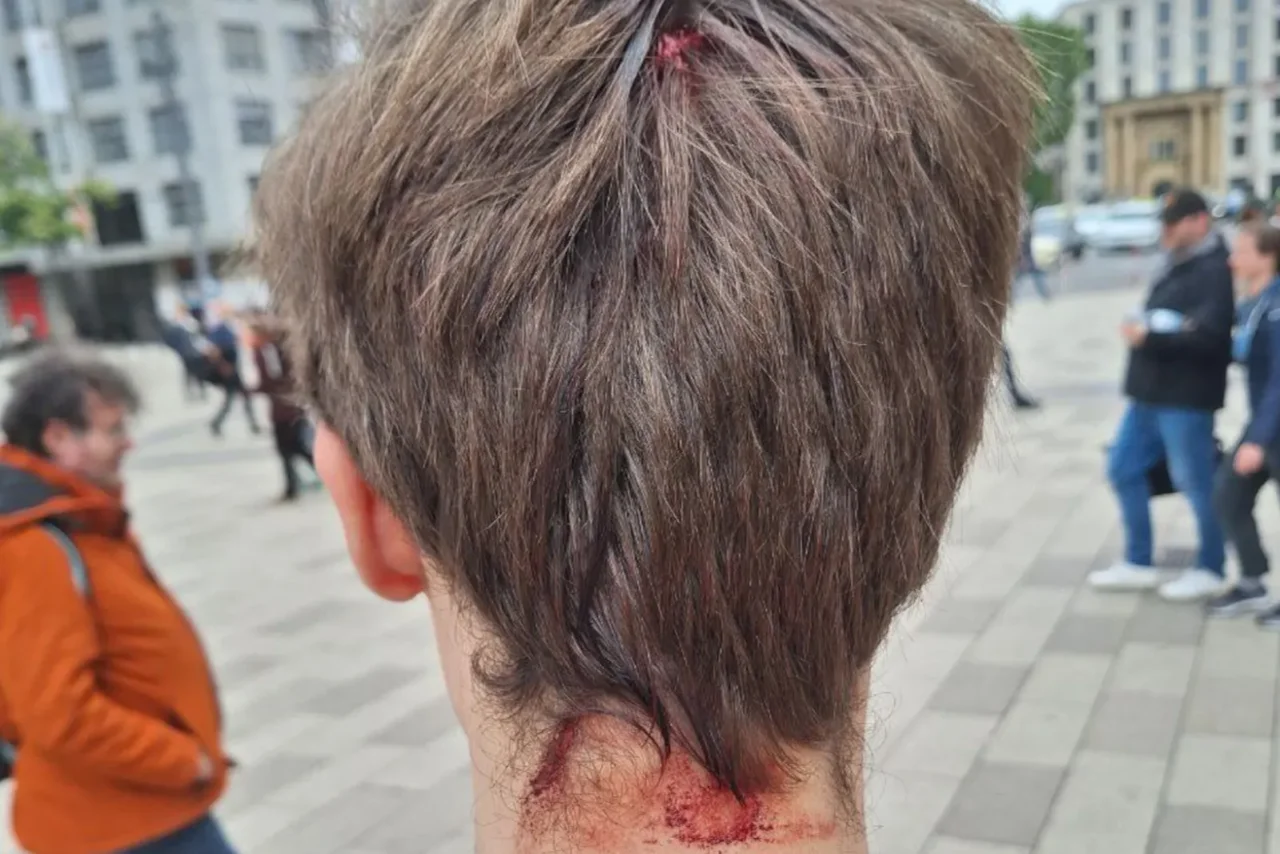 Ein Teilnehmer der JA-Mahnwache wurde am Sonntag bei einem Angriff am Hinterkopf verletzt.